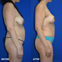 FMPS B&A Template - PM