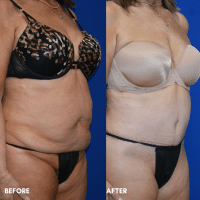 OLD FMPS B&A Template - TT W/ Flank Lipo (3)