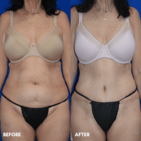 OLD FMPS B&A Template - TT w/ flank lipo