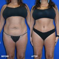 FMPS B&A Template - 94