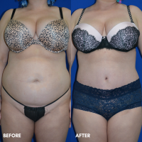 FMPS B&A Template - TE