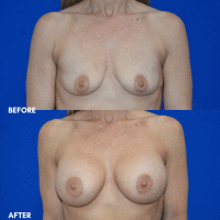 FMPS/CFPS B&A Templates Website - BBA- A1