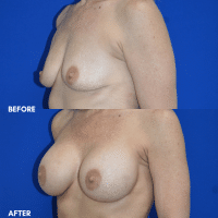 FMPS/CFPS B&A Templates Website - BBA- A2