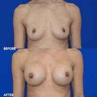 OLD FMPS B&A Template - Front BBA