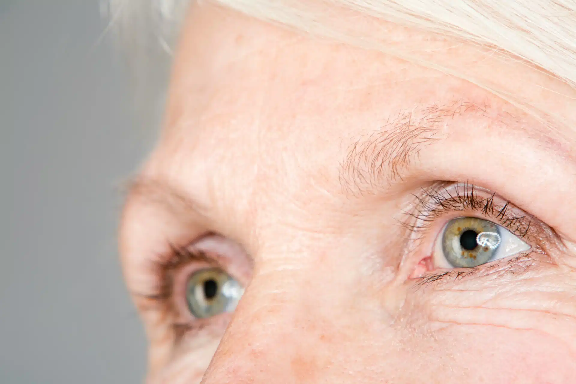 brow lift